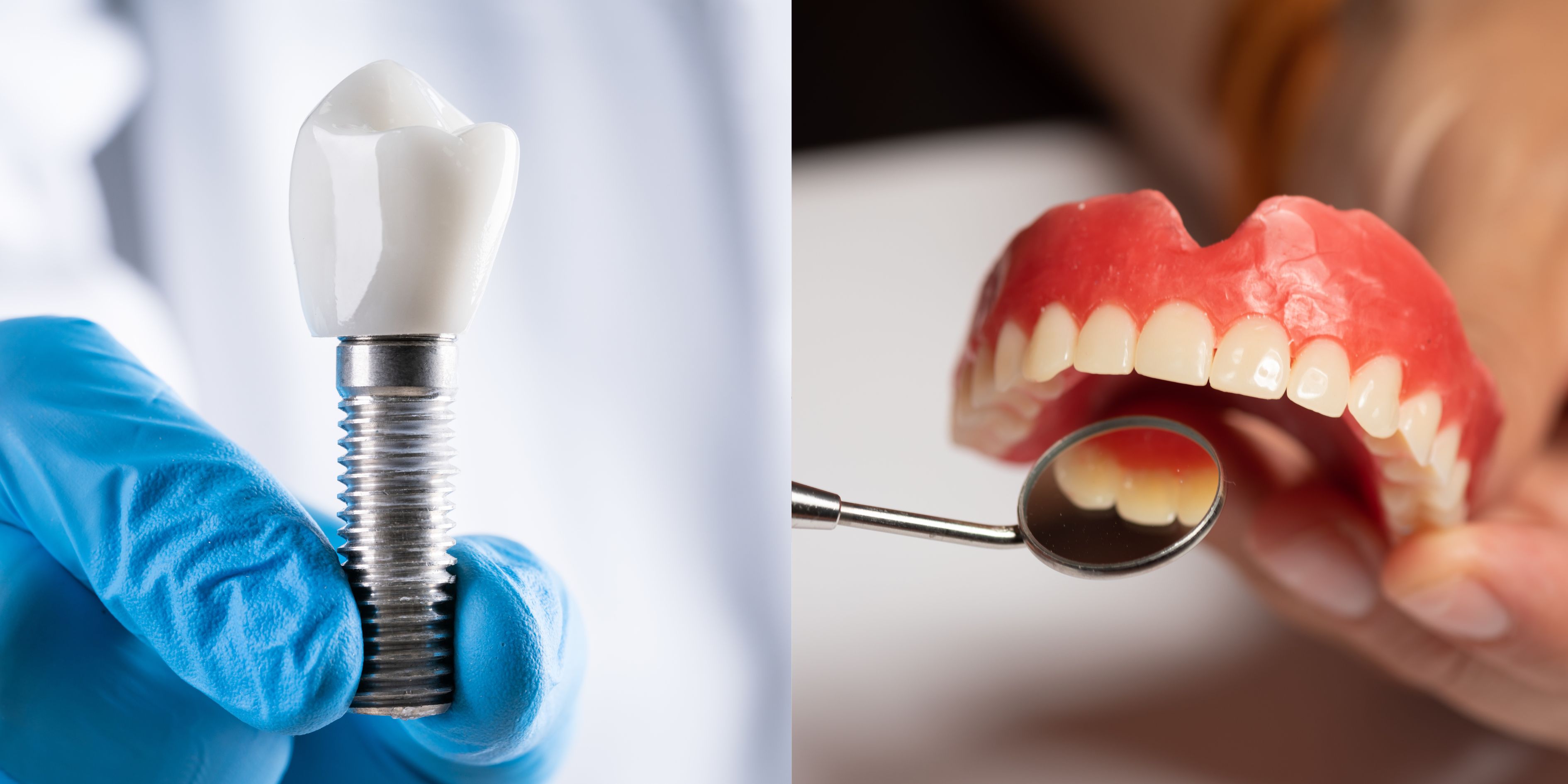 Dental implants vs dentures – Dr Radhesh Rao Bhandup Mumbai